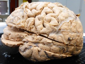 This shows a brain with cuts in the horizontal plane.